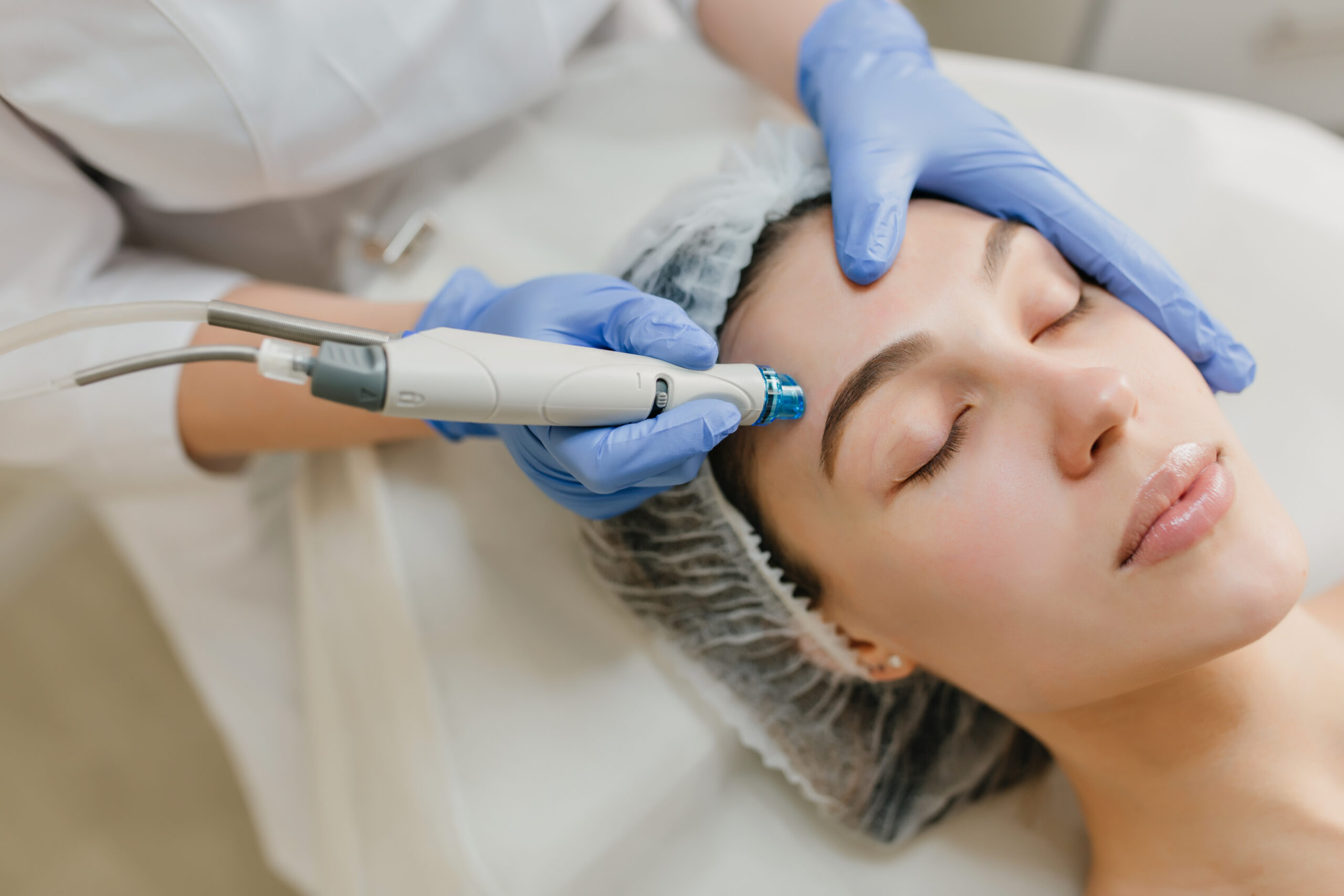 Fractional Rf Microneedling lipogen.net